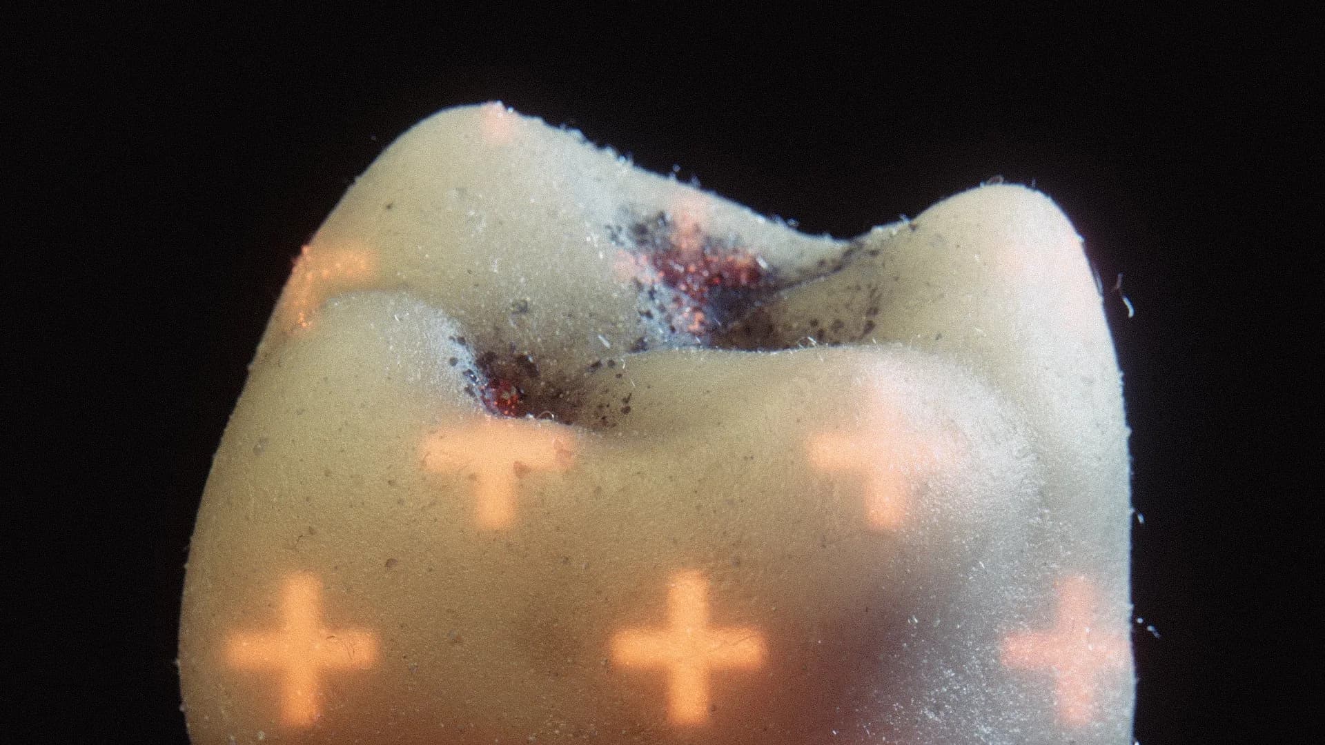 DELPHER 876 — tooth_crop_01